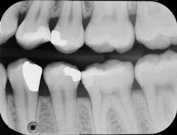 1705derho P05 1705derho P05