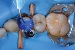 1705derho P06 1705derho P06