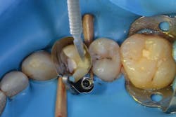 1705derho P07 1705derho P07