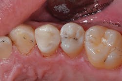 1705derho P08 1705derho P08