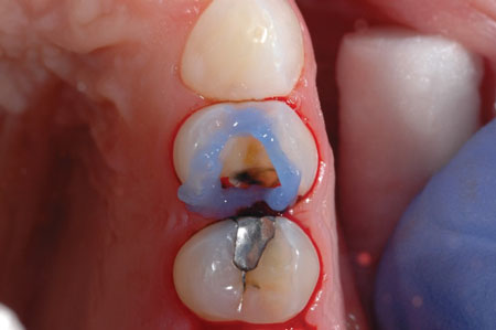 Content Dam De Print Articles Volume 107 Issue 5 1705derho P02