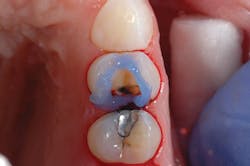 Content Dam De Print Articles Volume 107 Issue 5 1705derho P02 Content Dam De Print Articles Volume 107 Issue 5 1705derho P02