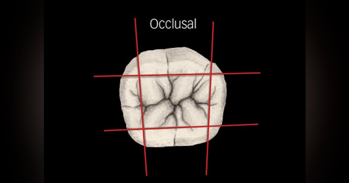 Surfaces for operative restorations A guideline for diagnosis and