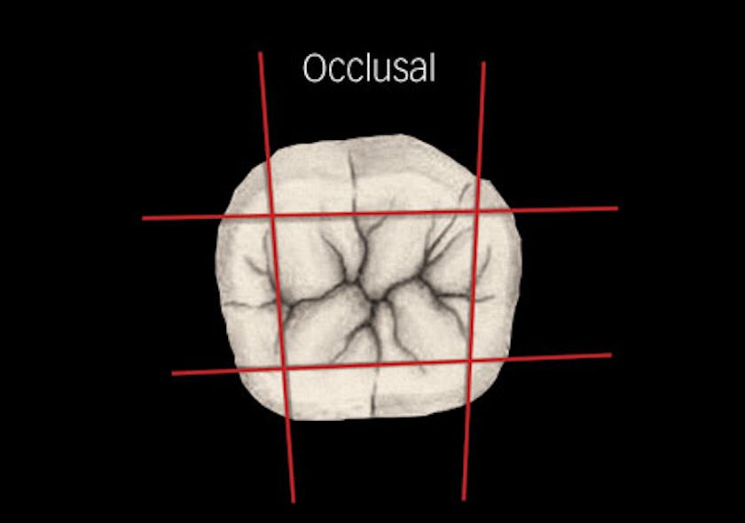Surfaces for operative restorations A guideline for diagnosis and