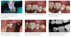 Ivoclar June Art1 Fig13 18 Ivoclar June Art1 Fig13 18