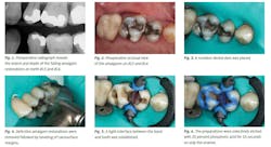 Ivoclar June Art1 Fig1 6 Ivoclar June Art1 Fig1 6