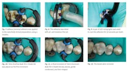 Ivoclar June Art1 Fig7 12 Ivoclar June Art1 Fig7 12