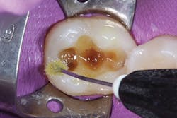 Ivoclar June Art3 Fig3 Ivoclar June Art3 Fig3