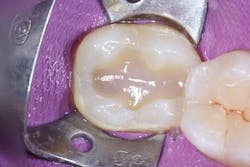 Ivoclar June Art3 Fig5 Ivoclar June Art3 Fig5