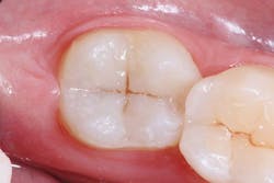 Ivoclar June Art3 Fig6 Ivoclar June Art3 Fig6