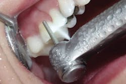 1706degoo P02 1706degoo P02