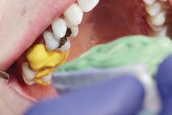 1706degoo P05 1706degoo P05