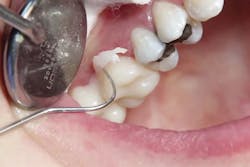 1706degoo P09 1706degoo P09