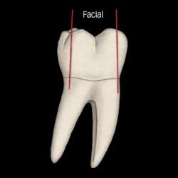 1706degra Z03 1706degra Z03