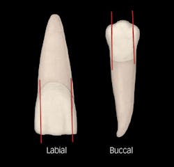 1706degra Z04 05 1706degra Z04 05