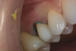 1706dehan P11 1706dehan P11