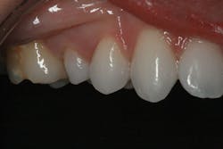 1706dehan P14 1706dehan P14