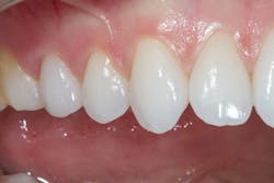 1706dehan P15 1706dehan P15