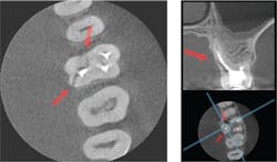 1706dekin P03 1706dekin P03