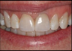 Ivoclar June Art5 Fig1 Ivoclar June Art5 Fig1