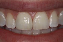 Ivoclar June Art5 Fig2 Ivoclar June Art5 Fig2