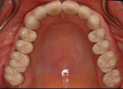 Ivoclar June Art5 Fig3 Ivoclar June Art5 Fig3