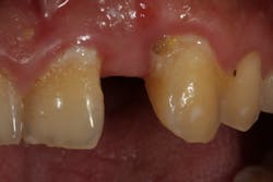 Ivoclar June Art5 Fig4 Ivoclar June Art5 Fig4