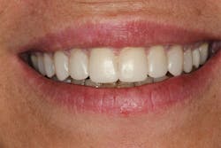 1707demis P03 1707demis P03