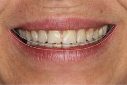 Content Dam De Print Articles Volume 107 Issue 7 1707demis P01t Content Dam De Print Articles Volume 107 Issue 7 1707demis P01t