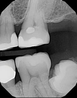 1708demil P01 1708demil P01