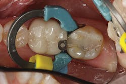 1708demil P03 1708demil P03