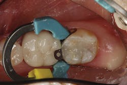 1708demil P04 1708demil P04