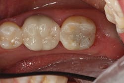 1708demil P05 1708demil P05