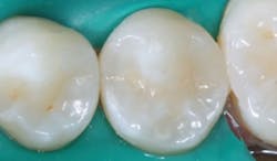 1709dechr P051 1709dechr P051