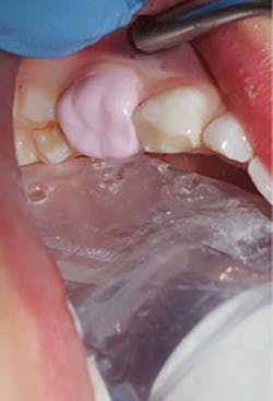 1709decoh P03 1709decoh P03