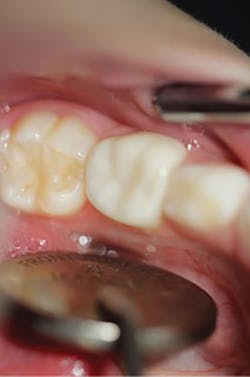 1709decoh P04 1709decoh P04