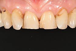 1709defer P01 1709defer P01