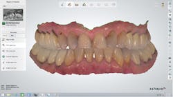 1709defer P02 1709defer P02