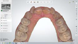 1709defer P03 1709defer P03