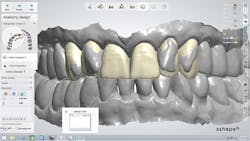 1709defer P04 1709defer P04