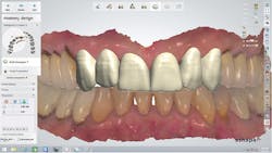 1709defer P05 1709defer P05