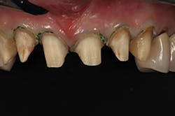 1709defer P07 1709defer P07