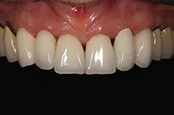 1709defer P08 1709defer P08