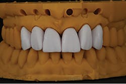 1709defer P10 1709defer P10