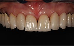 1709defer P11 1709defer P11