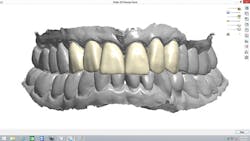 1709defer P12 1709defer P12