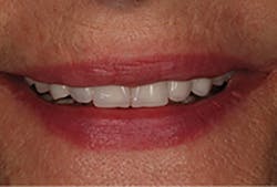 1709defer P13 1709defer P13