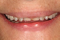 1709defer P14 1709defer P14