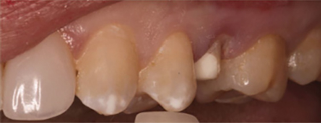 1709degan P01