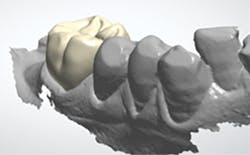 1709degan P04dig 1709degan P04dig